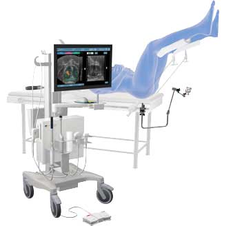 prostat fuzyon slayt